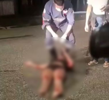 Imagem - Mulher fica ferida após ser 'atropelada' por cachorro em Icoaraci