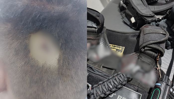 Policial é esfaqueado durante ocorrência em Ananindeua; suspeito morre baleado