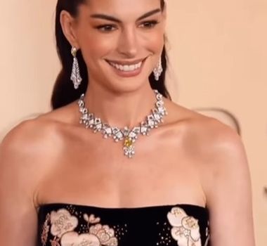 Imagem - Anne Hathaway revela truque para manter “rosto esticado” no Oscar