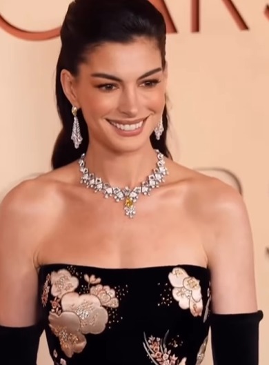 Imagem - Anne Hathaway revela truque para manter “rosto esticado” no Oscar