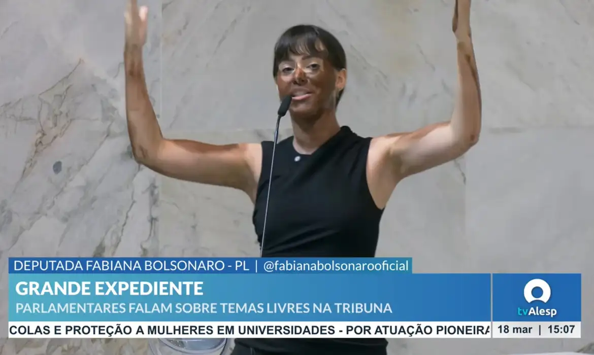 Imagem - Deputados pedem cassação de Fabiana Bolsonaro por blackface na Alesp