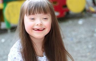 Saúde bucal é fundamental para pessoas com Síndrome de Down, alerta especialista