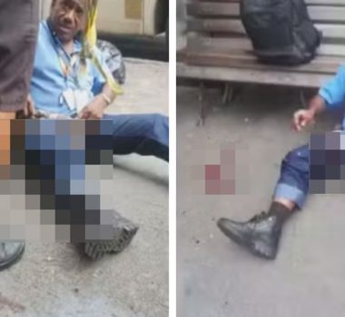 Imagem - Explosão de bomba caseira deixa oito feridos na Ilha do Governador, no Rio de Janeiro