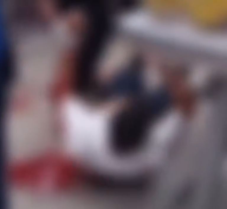 Funcionário ensanguentado após a briga