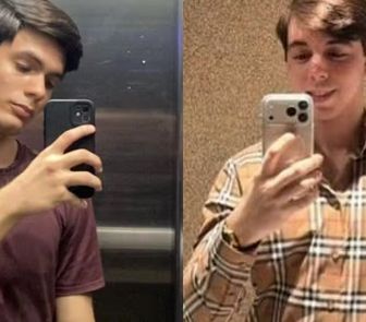 Imagem - Laudo confirma uso de arma de choque em agressão a homem em situação de rua em Belém