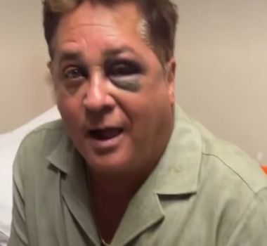 Imagem - Cantor Leonardo sofre acidente durante pescaria e passa por exames em Goiânia