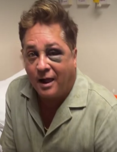 Imagem - Cantor Leonardo sofre acidente durante pescaria e passa por exames em Goiânia