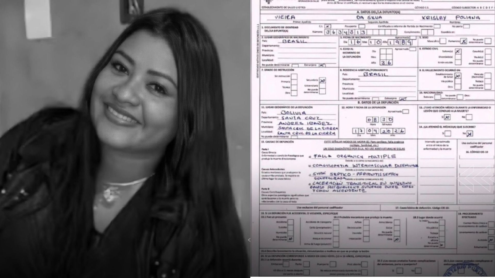 Laudo aponta as causas da morte de paraense após cirurgia plástica na Bolívia