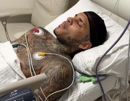 Anderson Neiff, fenômeno do bregafunk, é baleado em tentativa de assalto em São Paulo

