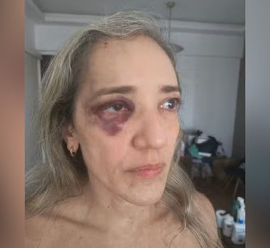 Imagem - Passageira denuncia agressão de motociclista de app após cancelar viagem