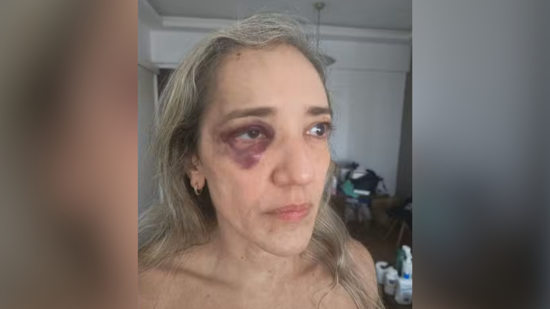 Mulher afirma ter sido atacada após reclamar de capacete sem viseira; condutor foi banido da plataforma.