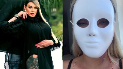 Andressa Urach chega à quinquagésima plástica e exibe pós-operatório