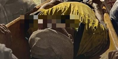 Integrante da Guarda de Nazaré que se feriu durante a Procissão Luminosa da Festividade de Fátima 2026.