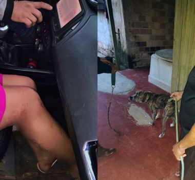 Imagem - Mulher é atacada por pitbull e PM resgata crianças durante ocorrência no Pará