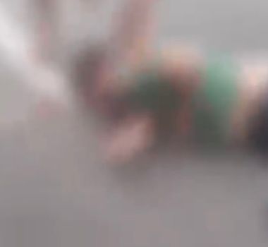 Imagem - Motociclista fica ferido após acidente na Augusto Montenegro, em Belém