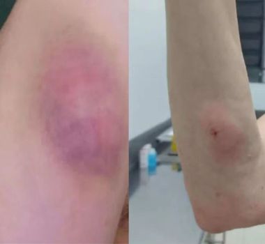Imagem - Veterinária aplica injeção em tutora por engano em clínica no interior de SP