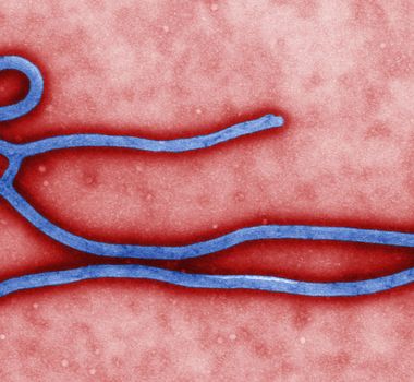 Imagem - Suspeita de ebola na Áustria acende sinal de alerta e põe paciente em isolamento total