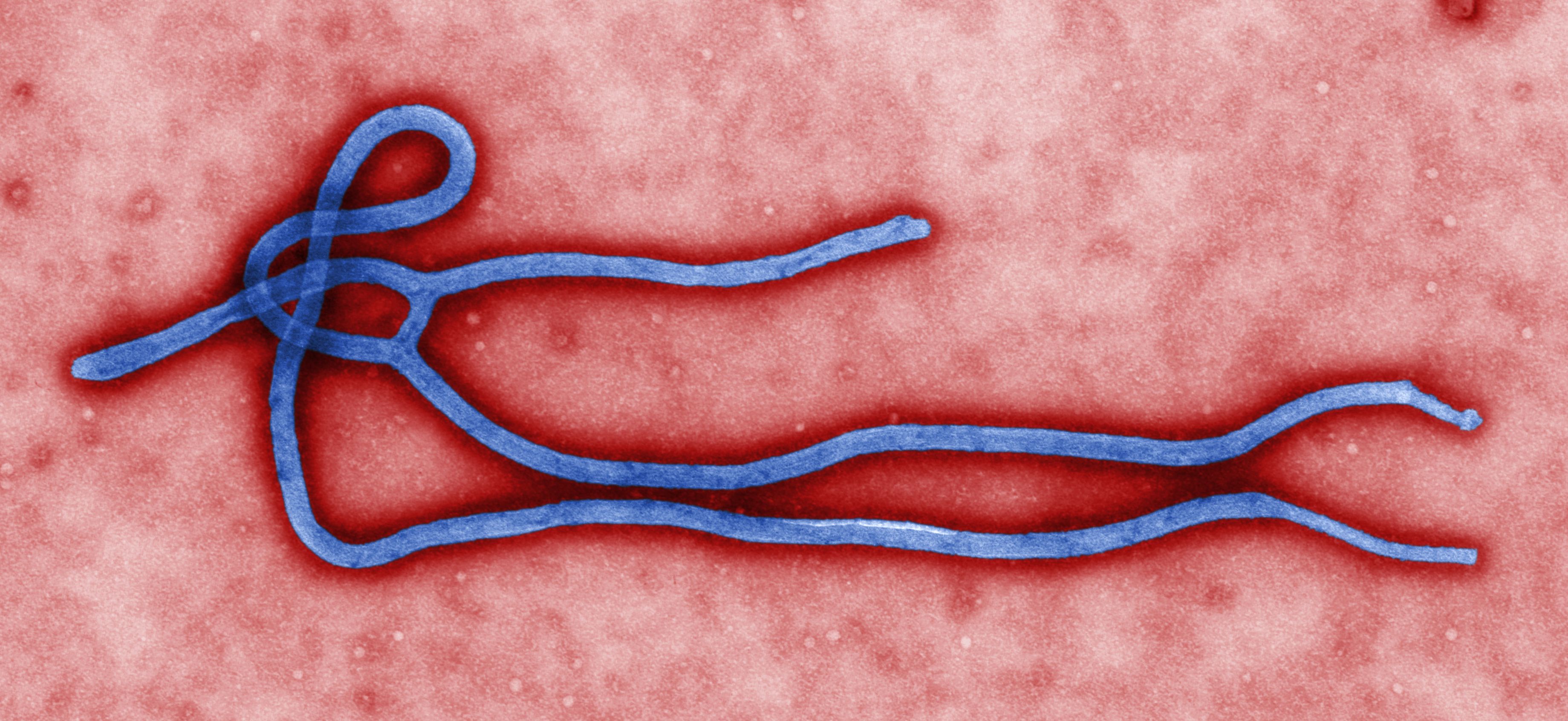 Suspeita de ebola na Áustria acende sinal de alerta e põe paciente em isolamento total