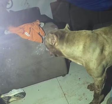 Imagem - Menino autista fica gravemente ferido após ataque de pitbull em Santarém