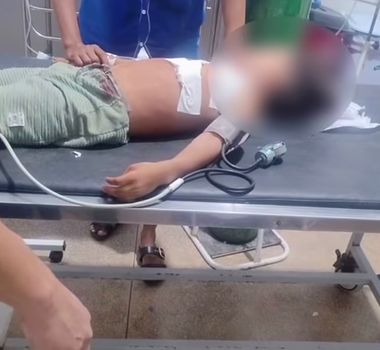 Imagem - Menino de 5 anos é baleado enquanto dormia dentro de casa em Curionópolis