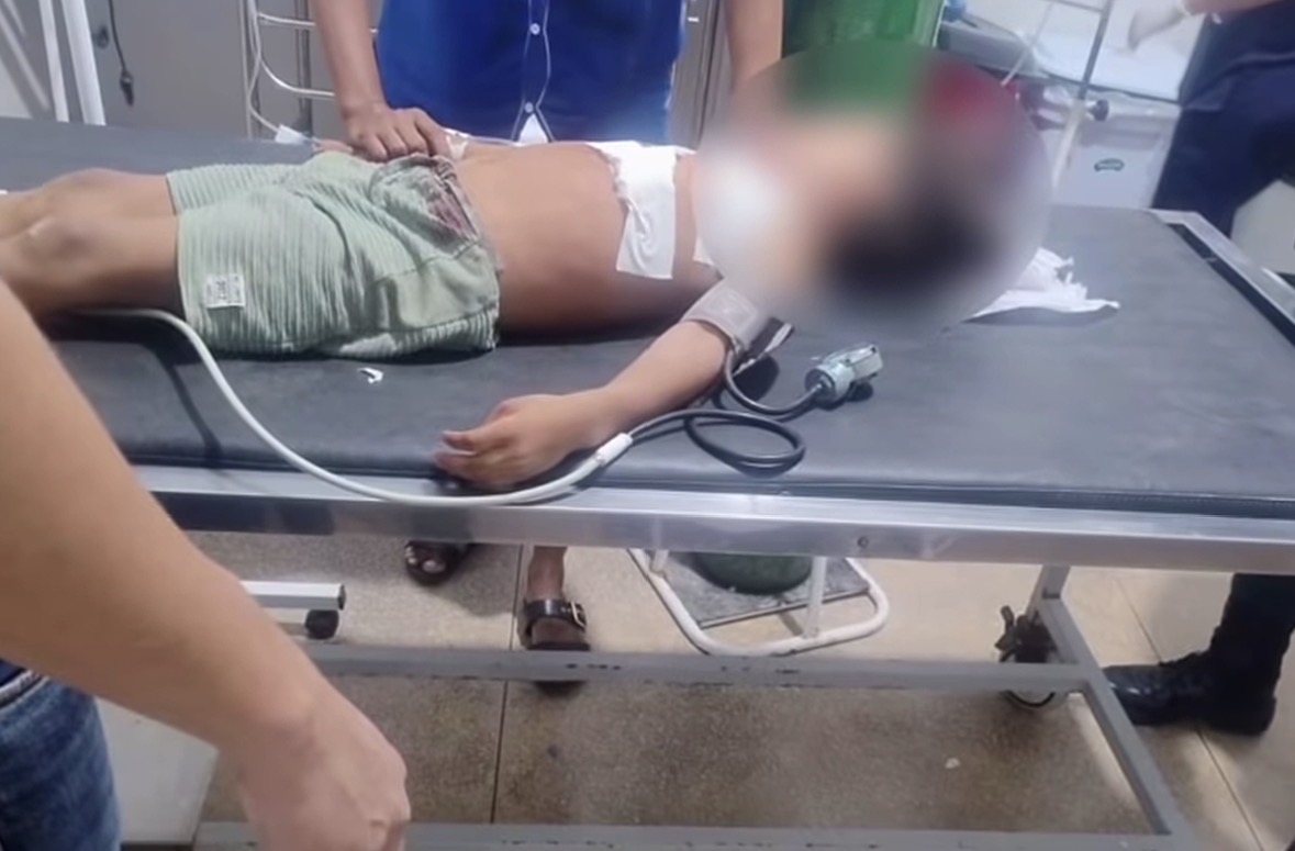 Imagem - Menino de 5 anos é baleado enquanto dormia dentro de casa em Curionópolis