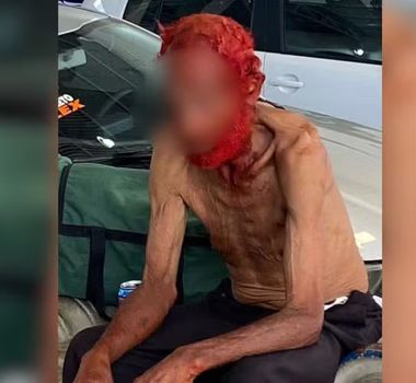 Imagem - Família pede justiça após idoso ter cabelo e barba pintados de vermelho