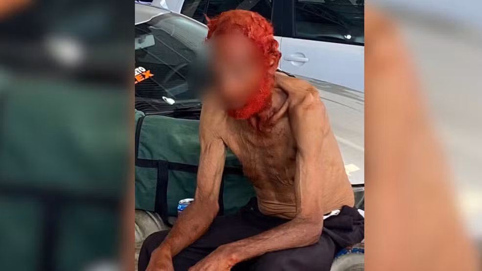 Parentes classificam episódio como humilhante e afirmam que homem de 83 anos vive em situação de vulnerabilidade devido à dependência química.