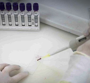 Imagem - São Paulo investiga caso suspeito de ebola em brasileira vinda do Congo