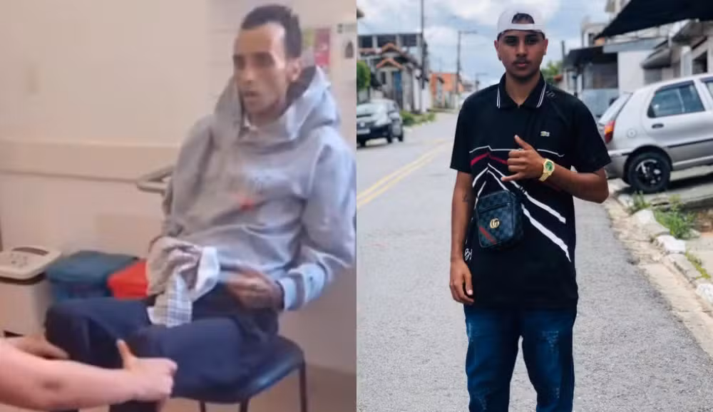 Guilherme Torres, de 22 anos, compartilhou parte da recuperação nas redes sociais após ingerir bebida adulterada em 2025.