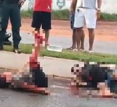 Imagem - Acidente de moto deixa criança de 11 anos gravemente ferida no bairro do Jurunas, em Belém