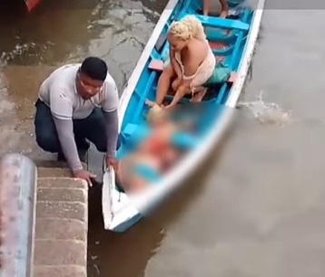 (Nas imagens, a mulher aparece sendo transportada em uma rabeta, embarcação bastante utilizada nas comunidades ribeirinhas da região, até receber atendimento médico.)