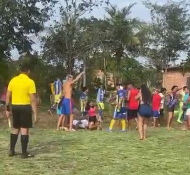 Imagem - Partida de futebol termina em briga e jovem com traumatismo craniano em Curuçá