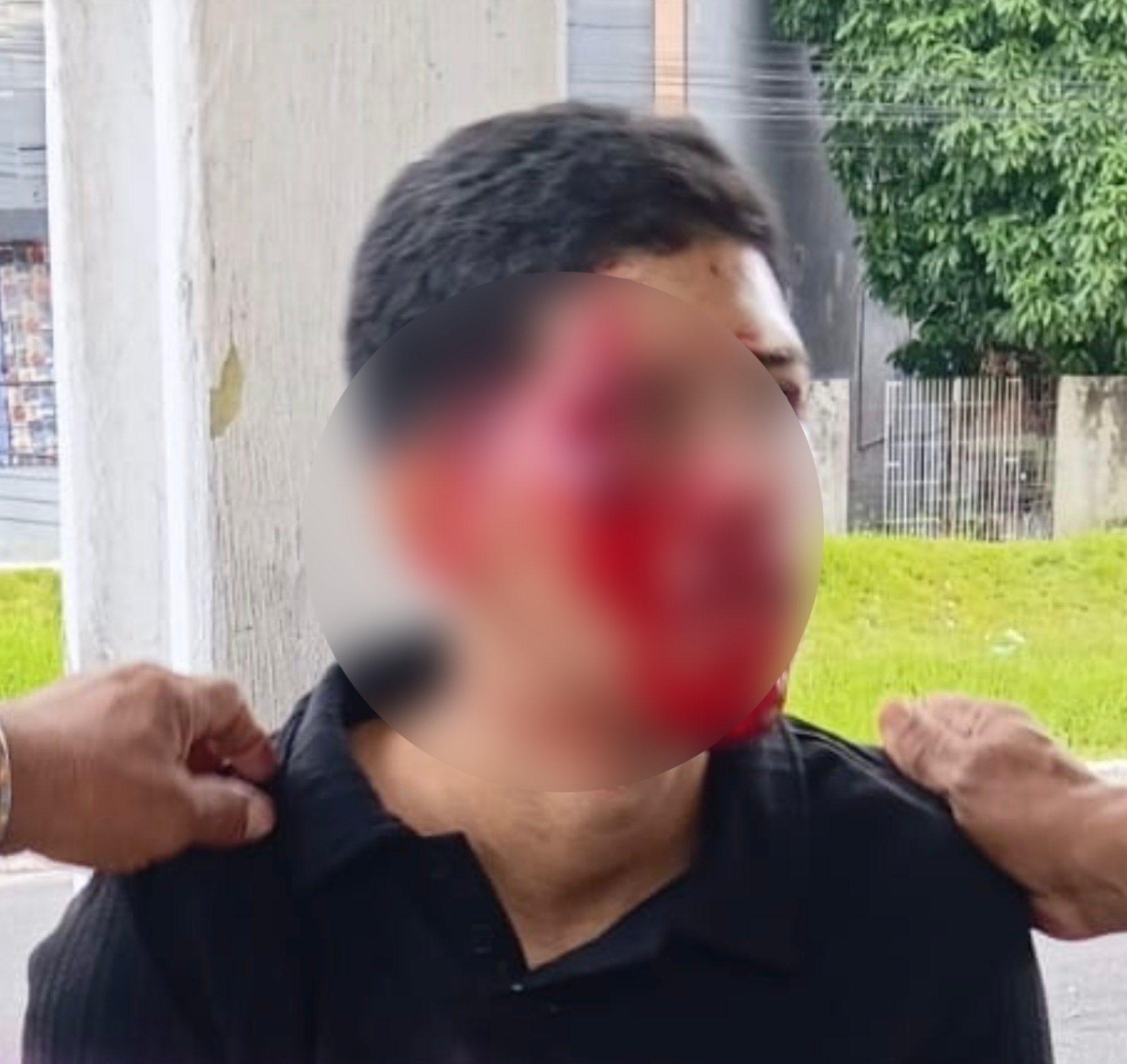 Jovem fica ferido após acidente de moto - 