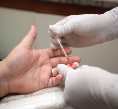 Imagem - Julho Amarelo leva testagem gratuita para hepatites, HIV e sífilis em Belém