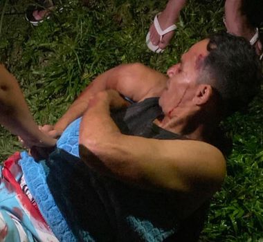 Imagem - Homem é baleado durante tentativa de homicídio, em Castanhal
