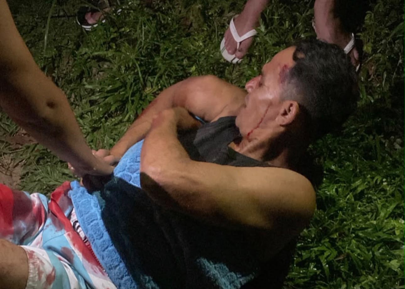 Homem é baleado durante tentativa de homicídio, em Castanhal