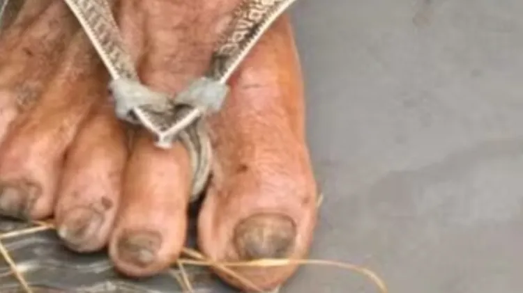Vítima de 65 anos vivia isolada em propriedade rural e bebia água do rio. 