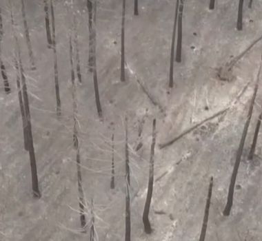 Imagem - Incêndio florestal devasta mais de 30 mil hectares na Espanha