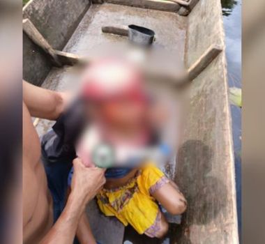 Imagem - Criança sofre escalpelamento em acidente com embarcação no Marajó