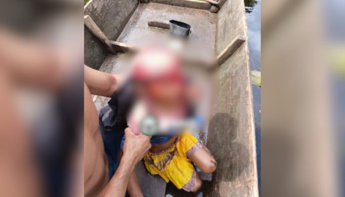 Criança sofre escalpelamento em acidente com embarcação no Marajó