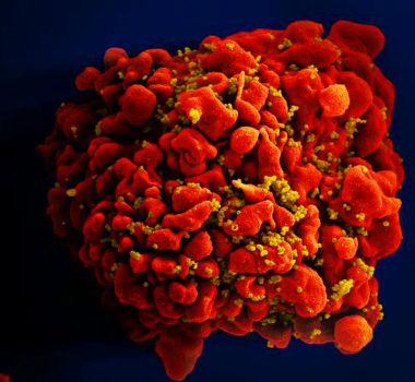 Imagem - Dois novos casos de cura do HIV renovam esperança por uma futura cura