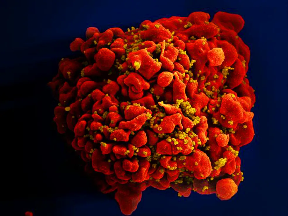 Célula infectada por partículas do vírus HIV, anexas à superfície - 