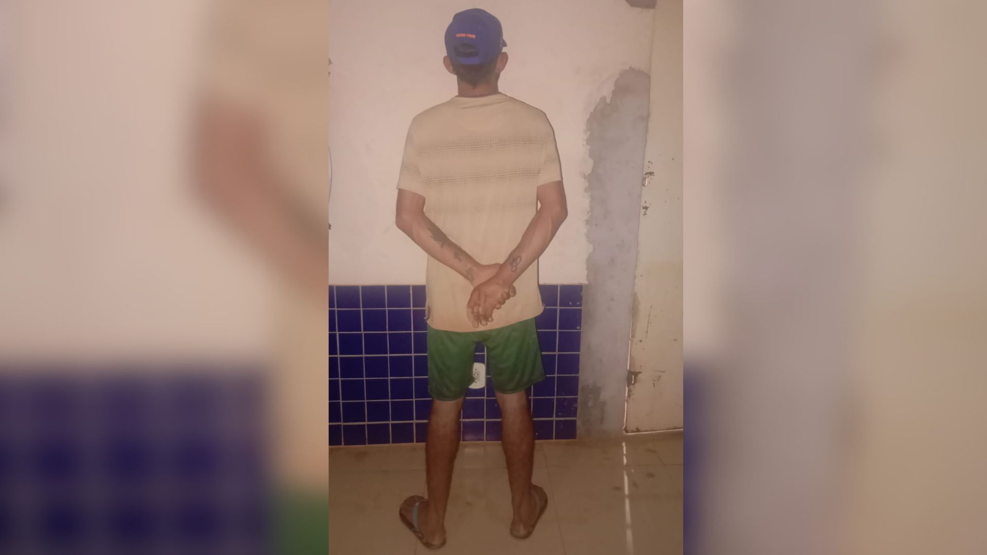 Mulher é agredida e mordida pelo companheiro em Tucumã, no Pará