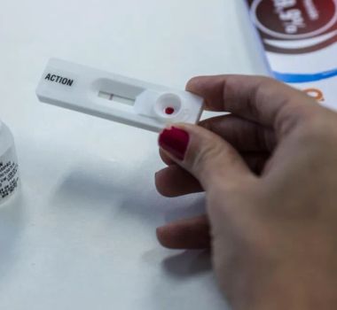 Imagem - Apesar da queda de casos no país, municípios do Pará seguem entre os que mais registram HIV e aids