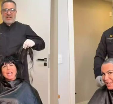 Imagem - Gretchen raspa a cabeça antes de transplante capilar