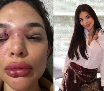Imagem - Empresário da Faria Lima é preso em flagrante por suspeita de violência doméstica em São Paulo