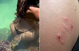 Modelo paraguaia leva mordida de tartaruga durante ensaio fotográfico em Zanzibar