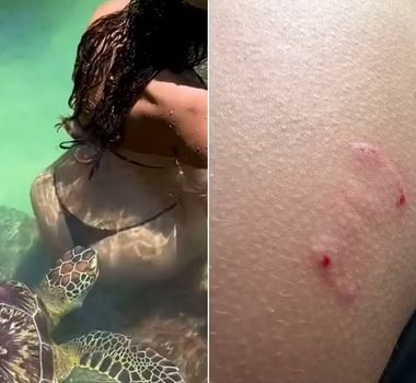 Imagem - Modelo paraguaia leva mordida de tartaruga durante ensaio fotográfico em Zanzibar