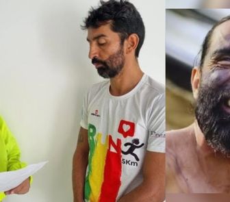 Imagem - 'Homem-peixe' que  está no Pará já foi preso por abuso sexual infantil, diz imprensa internacional
