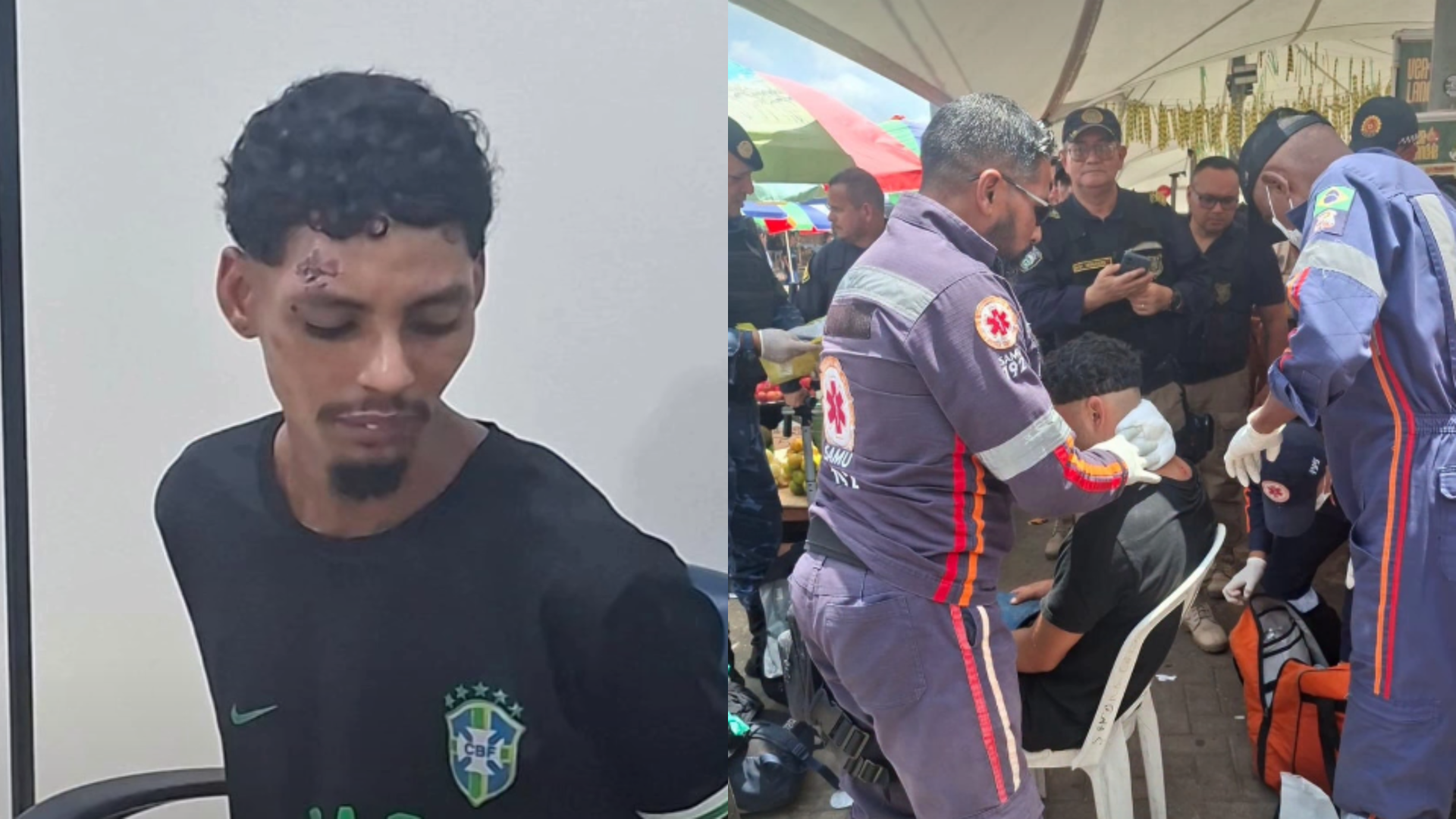 Vítima ficou consciente após o ataque e foi socorrida pelo SAMU; suspeito foi detido e levado para a delegacia.